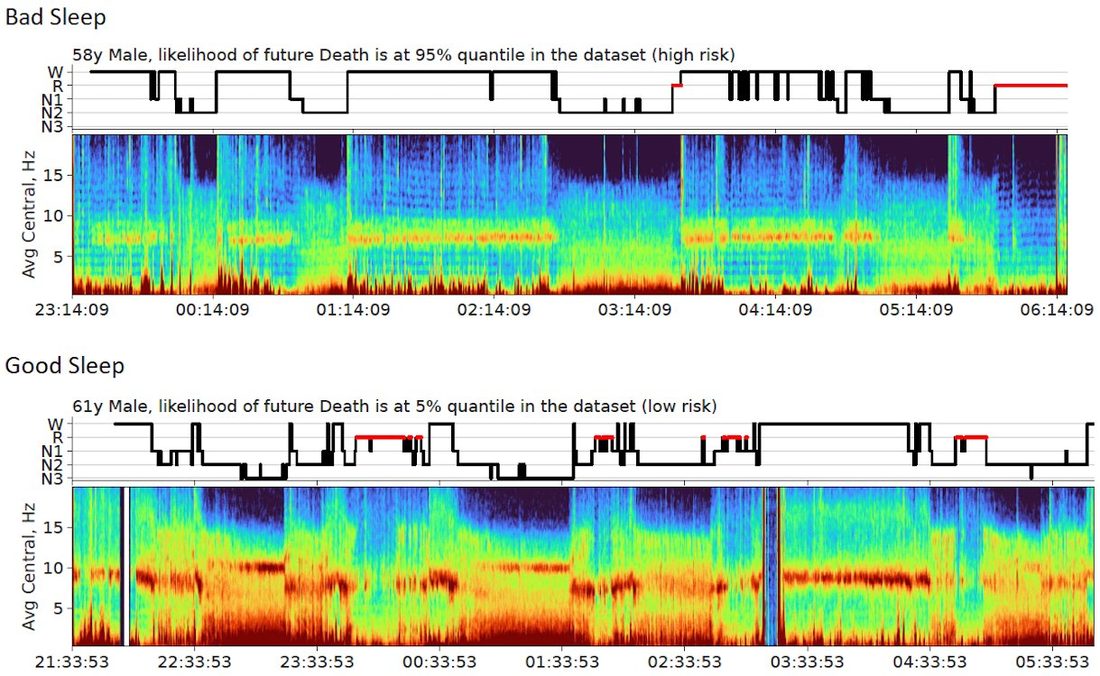 Two overnight sleep EEG spectrograms with sleep-stage plots above them. The first, from a 58-year-old man, is labelled high risk; the second, from a 61-year-old man, is labelled low risk.