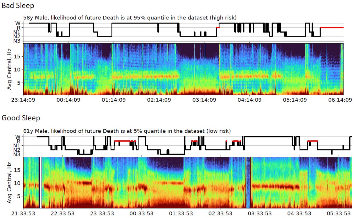 BDSP spectrogram example